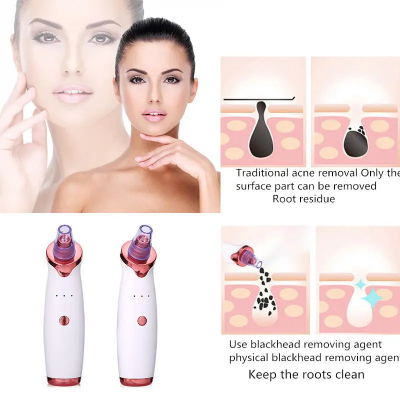 Blackhead Remover Instrument Black Dot Remover Acne Vacuum Suction Face Clean Black Head Pore Cleaning Beauty Skin Care Tool eprolo